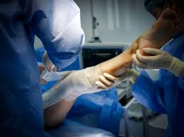 Surgical Interventions