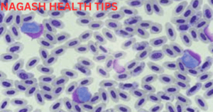 Malaria