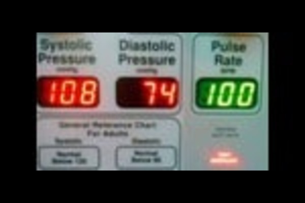 low blood pressure