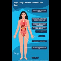  body gets cancer