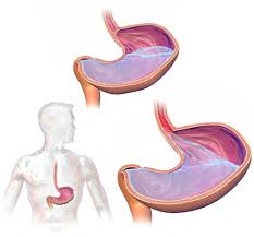 Gastroesophageal reflux contamination 